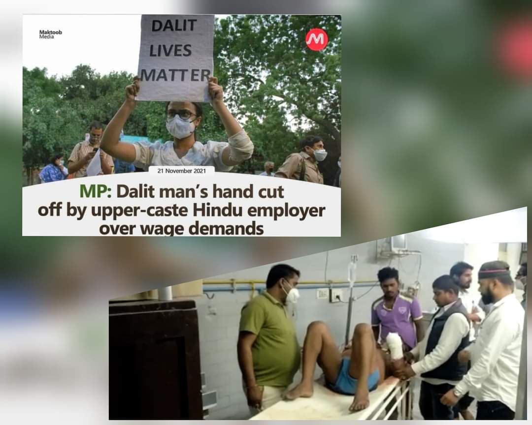মধ্যপ্রদেশে মজুরি চাওয়ায় ব্রাহ্মণ ঠিকাদার, দলিত শ্রমিকের হাত কেটে নিল