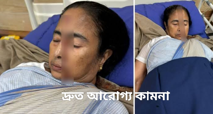 মমতা বন্দ্যোপাধ্যায়ের কপালে আঘাত হাসপাতালে , দ্রুত আরোগ্য কামনা