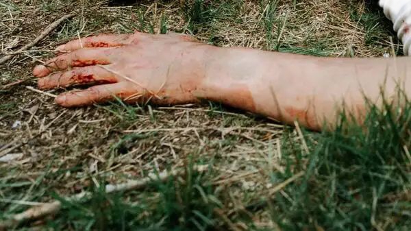 আবার মহিলার রক্তাক্ত দেহ, আনন্দপুর নোনাডাঙায়, শরীরে আঘাতের চিহ্ন